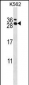RCAN3 Antibody (C-term)